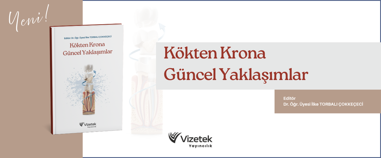 Vizetek - 1