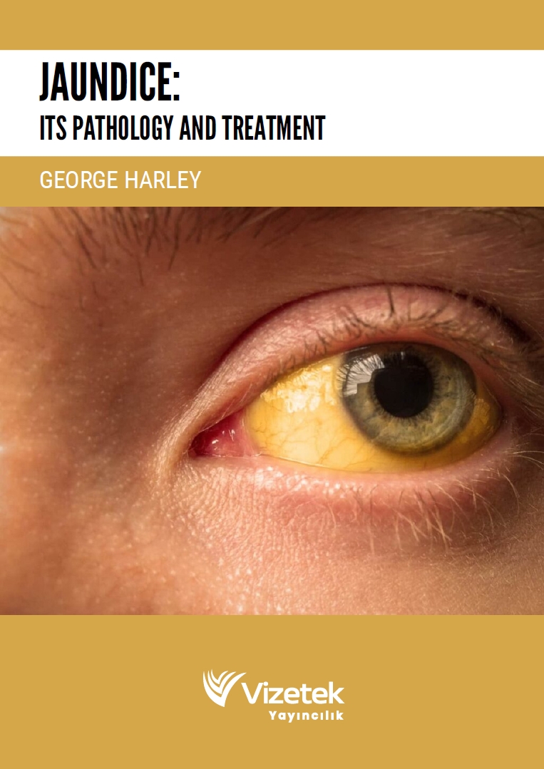 Jaundıce: Its Pathology And Treatment