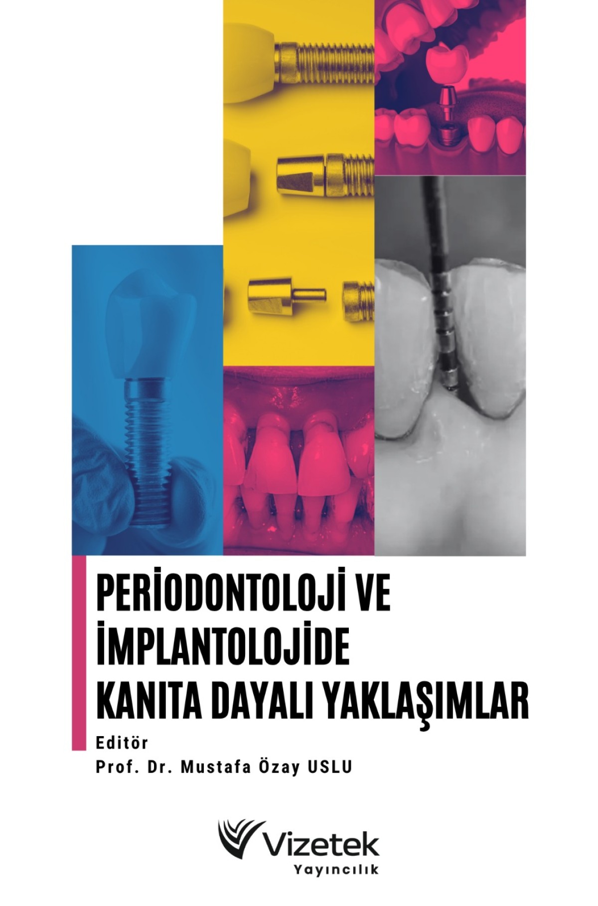 Periodontoloji ve İmplantolojide Kanıta Dayalı Yaklaşımlar