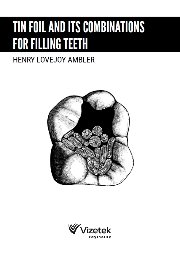 Tin Foil and Its Combinations for Filling Teeth Tin Foil and Its Combinations for Filling Teeth