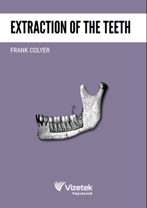 Extraction of the Teeth